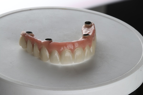 Will I Need A Bone Graft For The All On   Procedure?