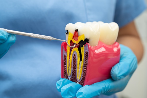 When Root Canal Retreatment Is An Emergency