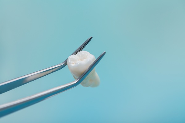 The Dos And Don&#    ;ts After Tooth Extraction